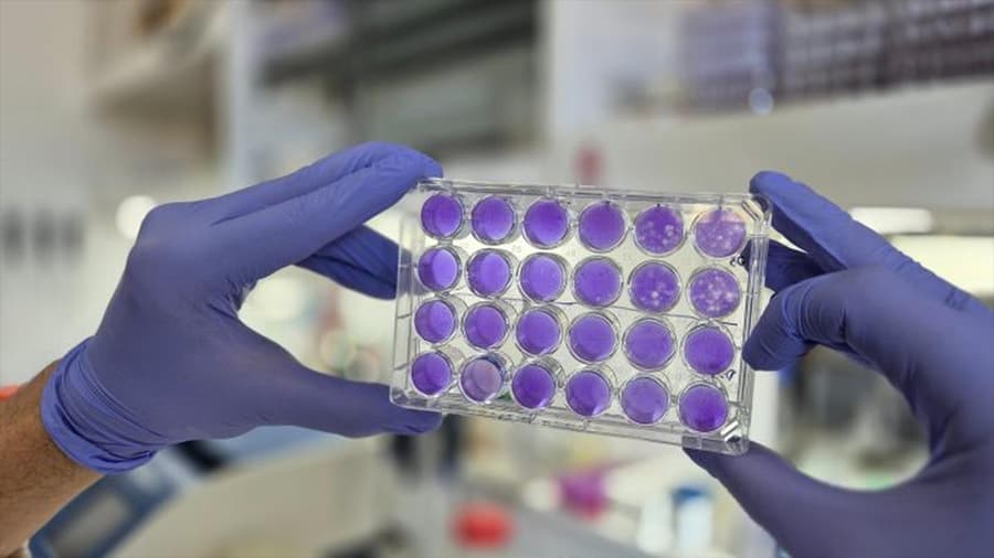 Avance argentino revela 'talón de Aquiles' común en virus del dengue, Zika y fiebre amarilla
