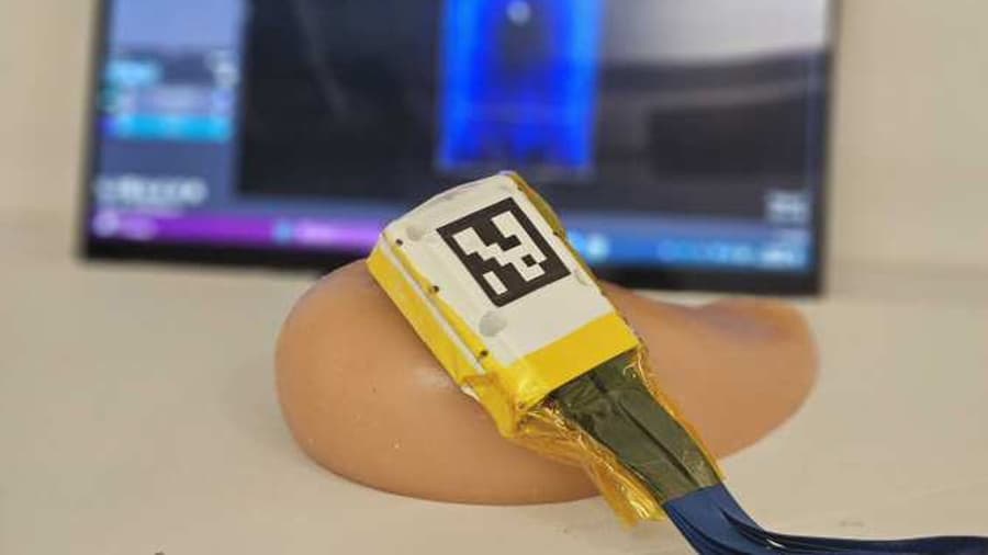 Escáner portátil de ultrasonido para mama: la detección temprana del cáncer llega al hogar